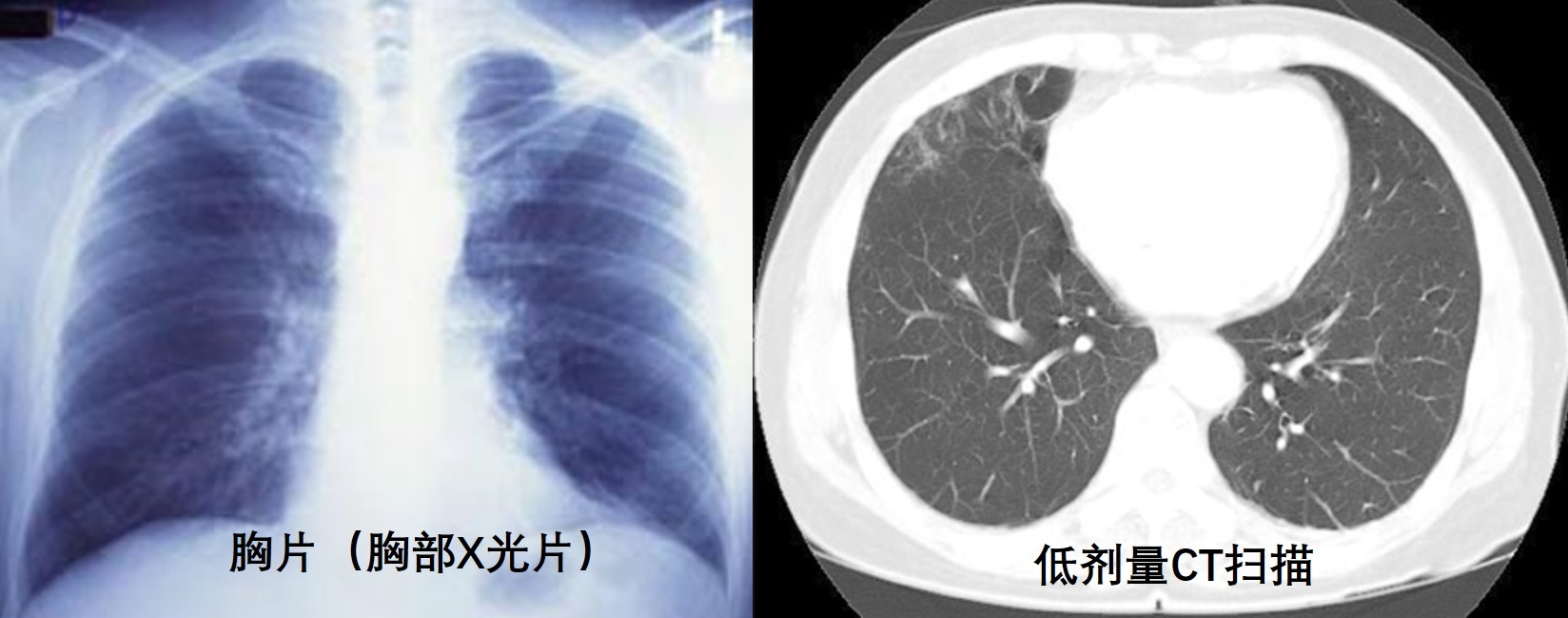 ΢Žͼ_20211101155350.png